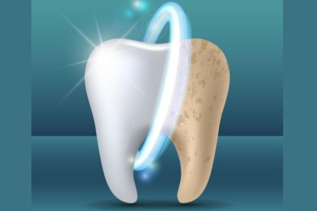 Blanchiment des dents et célébrités liées --Positive Dental