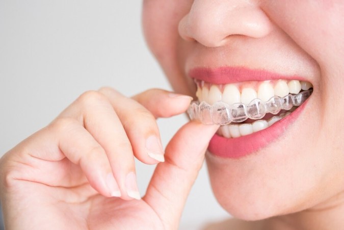 femme-souriante-tenant-des-accolades-invisalign-invisibles