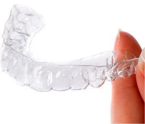 Attelle Invisalign