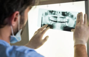 Dentiste avec radiographie